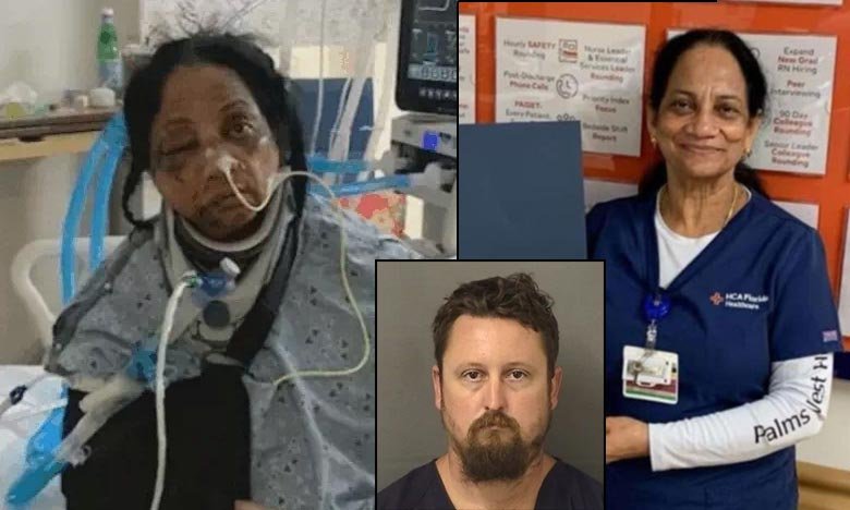 American Man Brutally Attacks Indian Nurse Facial Bones Fractured Risk of Losing Eyesight