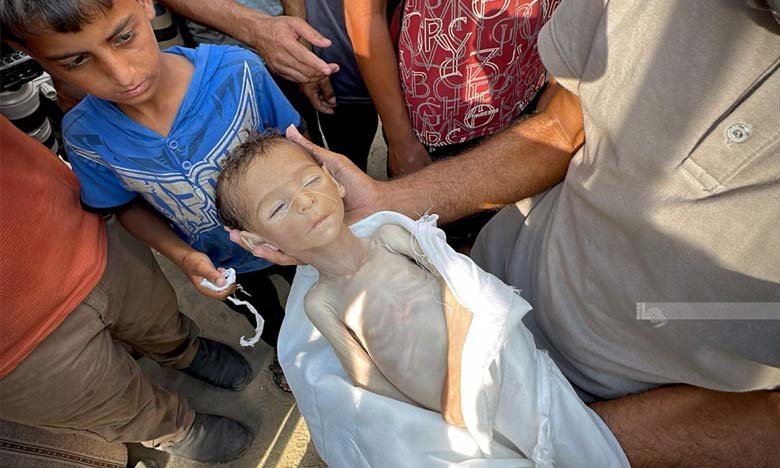 18 Die of Hunger in Gaza Within 24 Hours A Living Proof of Genocide