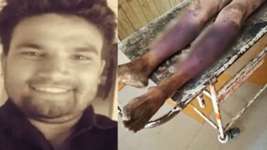 Mob Lynching in Indore Man Beaten to Death Suffers 40+ Fractures
