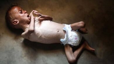 Water Instead of Milk Gazas Children Facing a Slow-Motion Death