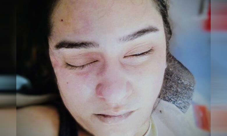 IndiGo Air Hostess from Jammu Dies by Suicide in Hyderabad Apartment