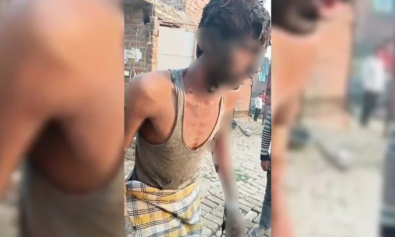 Youth Tied to Pole and Set on Fire After Dispute Over Prayers In Uttar Pradesh Mosque