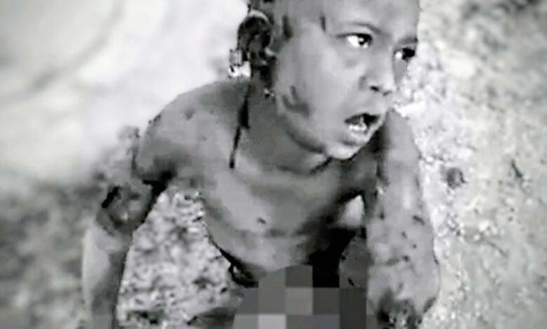 Stray Dogs Attack 8-Year-Old Mute Boy in Hyderabad Chief Minister Revanth Reddy Orders Immediate Action